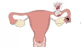 深圳宫外孕爆料新闻报道